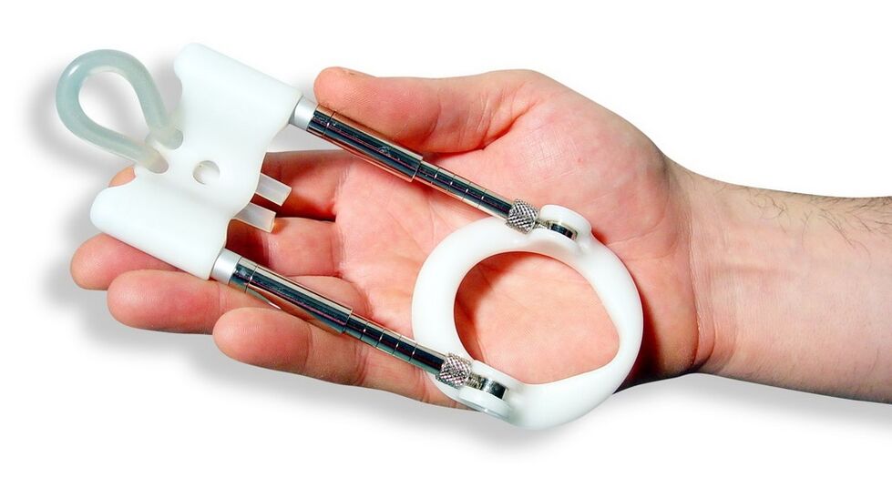 kiterjesztés a tag méretének növelése érdekében